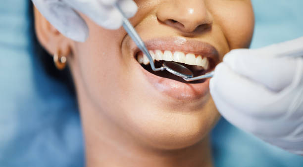 Best Emergency Root Canal Treatment in Rustburg, VA